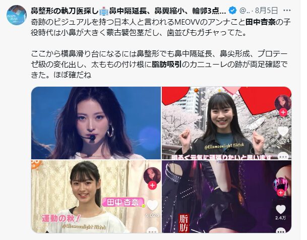 MEOVV田中杏奈 顔変わった 整形