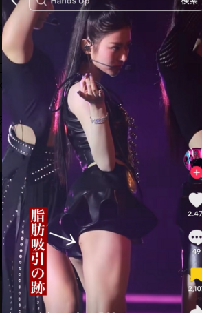 MEOVV田中杏奈 顔変わった 整形