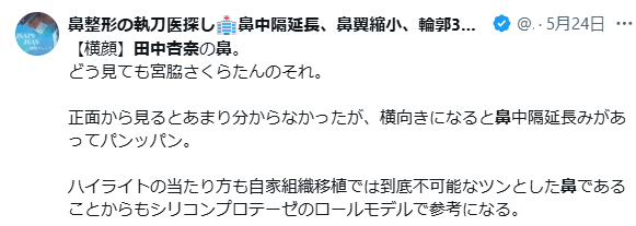 MEOVV田中杏奈 顔変わった 整形