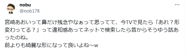 宮崎あおい　顔変わった　整形