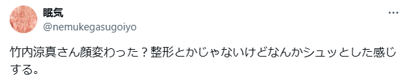 竹内涼真　顔変わった　整形