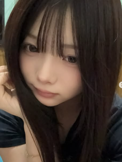 森元莉那　顔変わった　整形