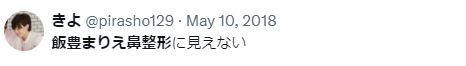 飯豊まりえ 整形 顔変わった