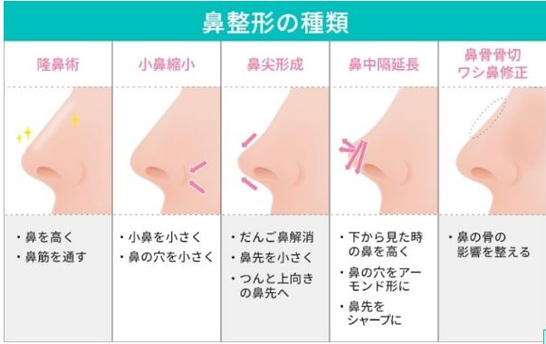 飯豊まりえ 整形 顔変わった