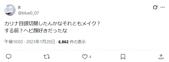 カリナ　整形　顔変わった