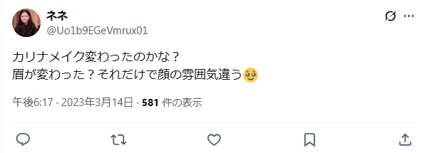 カリナ　整形　顔変わった