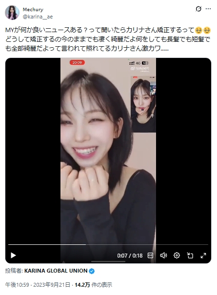 カリナ　整形　顔変わった