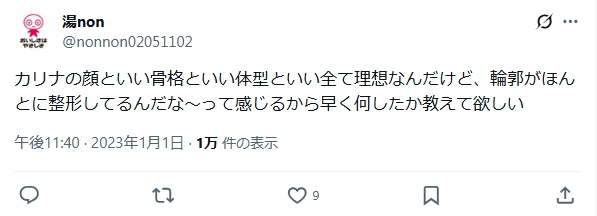 カリナ　整形　顔変わった