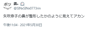 矢吹奈子 顔変わった 整形