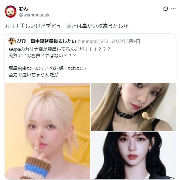 カリナ　整形　顔変わった