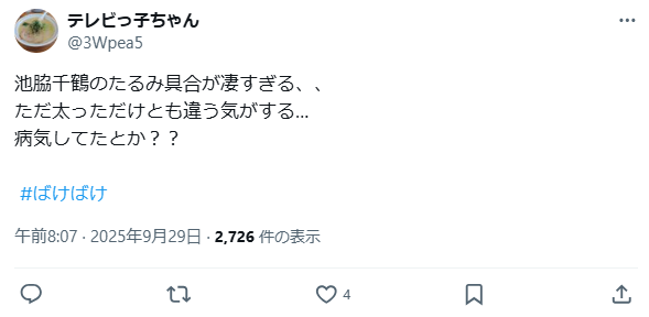 池脇千鶴　整形　顔変わった