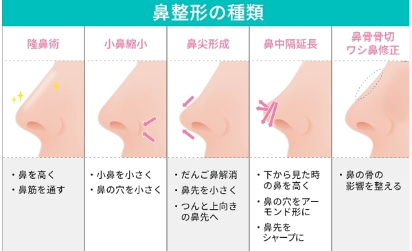 【ラブトラ3】しおり　整形　顔変わった