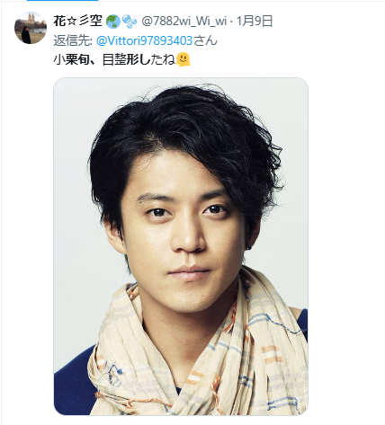 小栗旬 顔変わった 整形