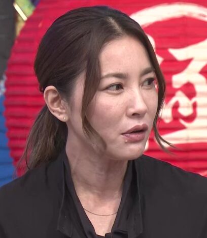 瀬戸朝香　顔ボコボコ