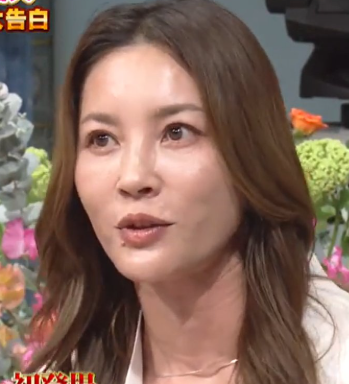 瀬戸朝香　顔ボコボコ