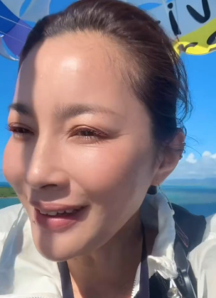 瀬戸朝香　顔ボコボコ