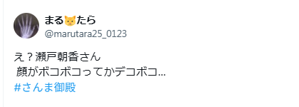 瀬戸朝香　顔ボコボコ