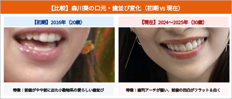 森川葵の口元・歯並び比較画像 デビュー初期と現在の歯列変化