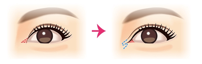 大森靖子 整形 顔変わった 大森靖子 整形 顔変わった