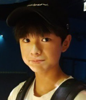 NCTユウシ　顔変わった　整形