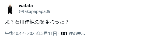 石川佳純 顔変わった 整形