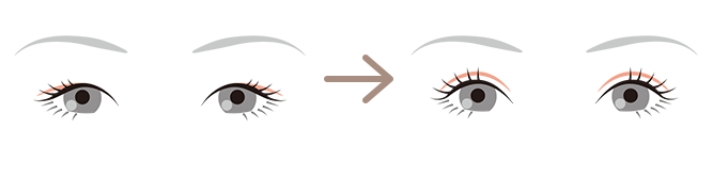 大森靖子 整形 顔変わった 大森靖子 整形 顔変わった