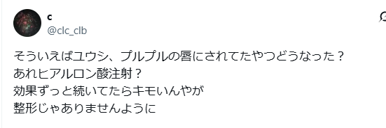 NCTユウシ　顔変わった　整形