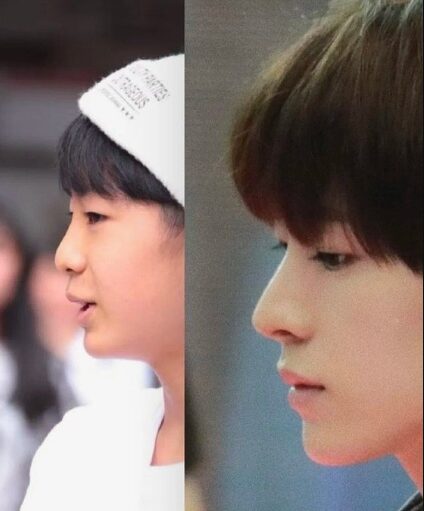 NCTユウシ　顔変わった　整形