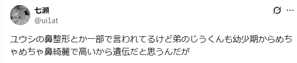 NCTユウシ　顔変わった　整形