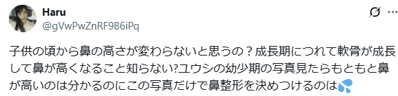 NCTユウシ　顔変わった　整形