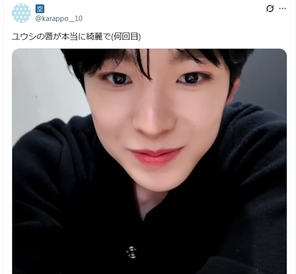 NCTユウシ　顔変わった　整形