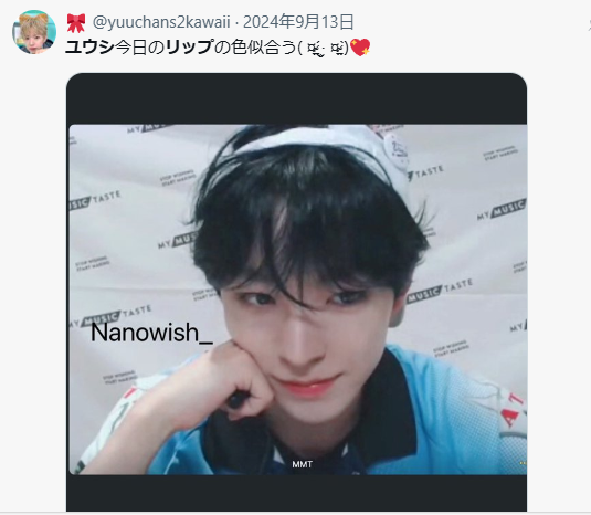 NCTユウシ　顔変わった　整形