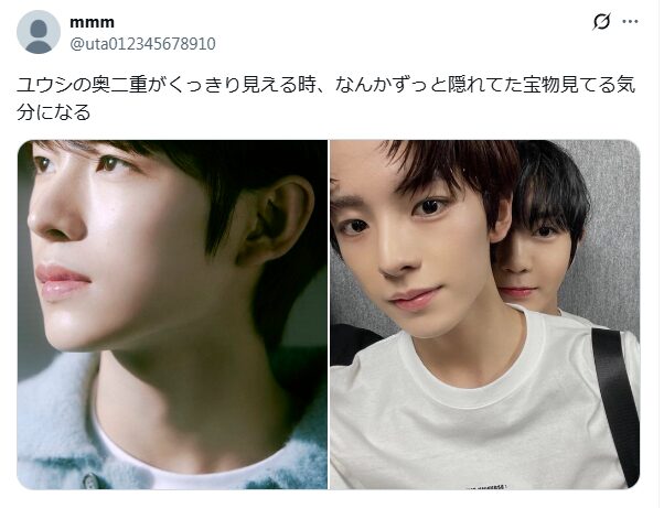 NCTユウシ　顔変わった　整形