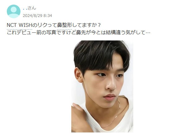 NCTWISHリク 顔変わった 整形