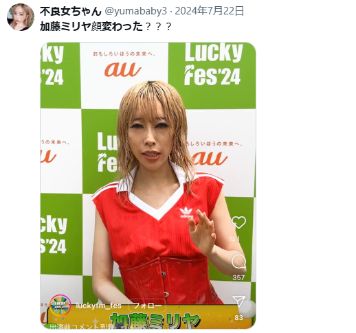 加藤ミリヤ　顔変わった　整形